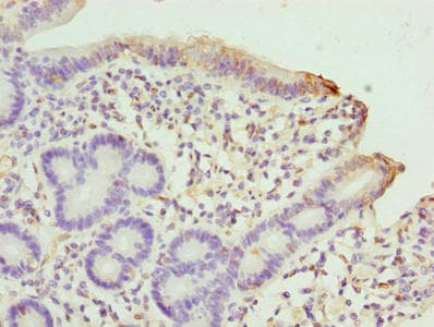 SCLT1 Antibody
