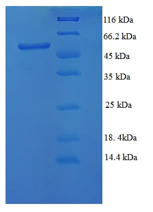 E. coli Modification methylase EcoRV Protein (Recombinant His-SUMO)