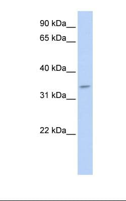 TNMD / Tenomodulin Antibody (aa74-123)
