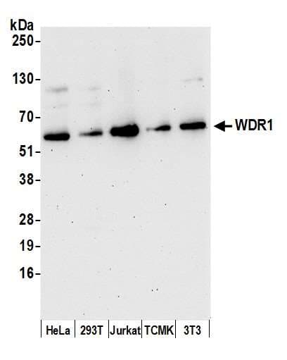 WDR1 Antibody (aa125-175)
