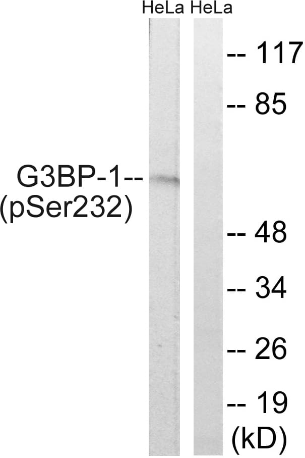 G3BP1 / G3BP Antibody (phospho-Ser232)