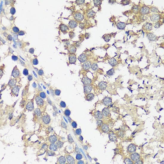 Polyclonal Rabbit anti-Human ASZ1 / Orf3 Antibody (IHC, IF)