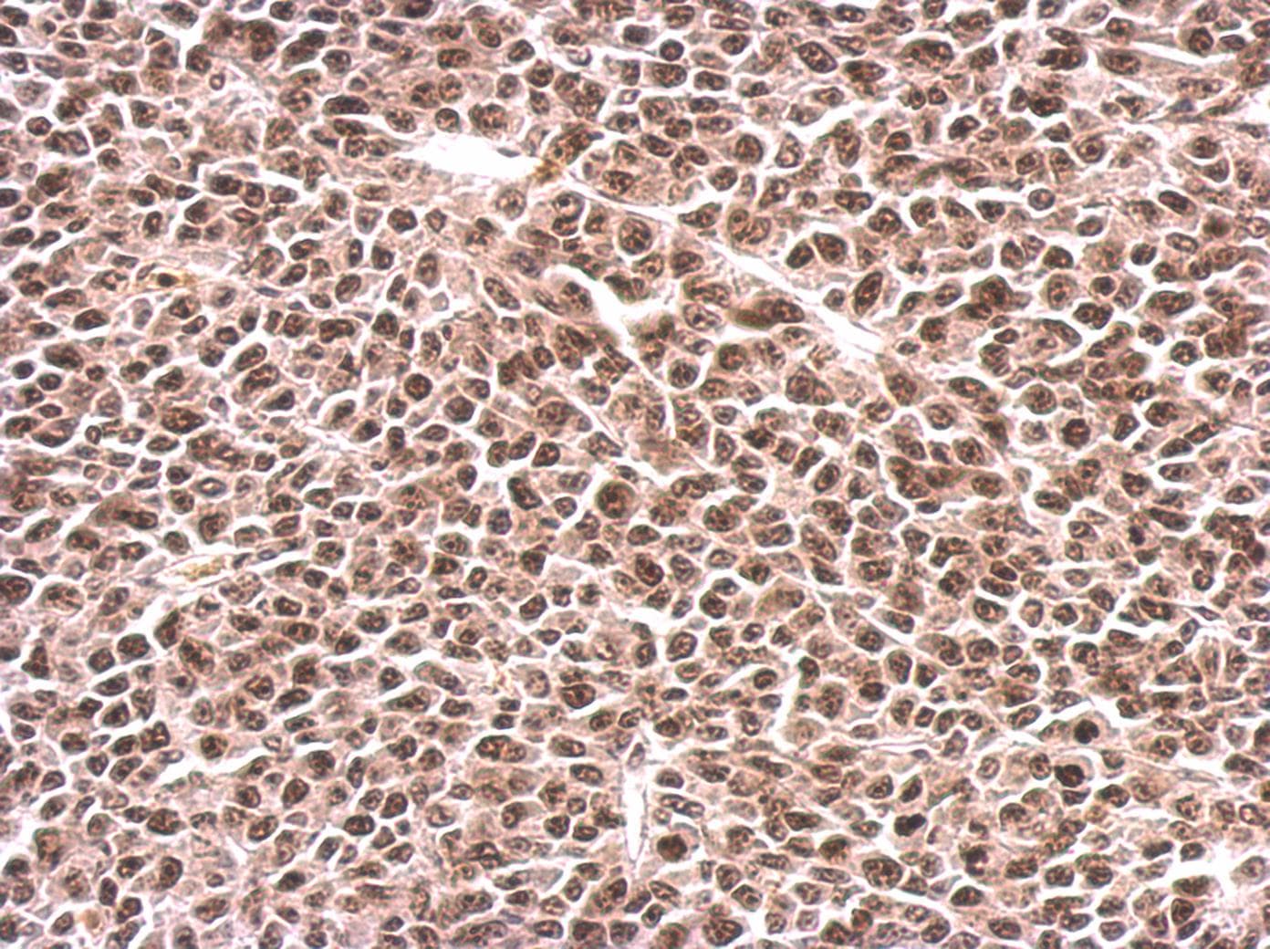 Polyclonal Rabbit anti-Human PFK2 / PFKFB3 Antibody (aa457-520, IHC, WB)