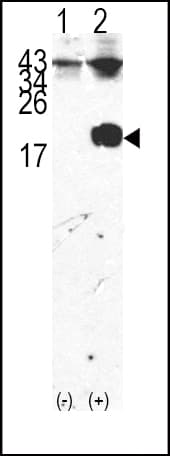 FKBP1A / FKBP12 Antibody (aa43-74)