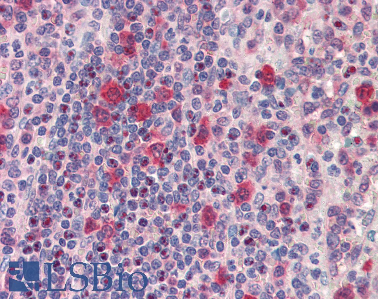 IHC-plus™ Polyclonal Rabbit anti-Human HSP90 / Heat Shock Protein 90 Antibody (IHC, WB)