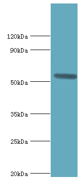 IHC-plus™ AGT / Angiotensinogen Antibody (aa35-285)