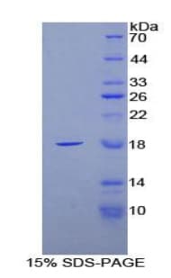 Rat FABP4 / AP2 Protein (Recombinant His-T7)