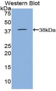 LF / LTF / Lactoferrin Antibody (aa25-352)