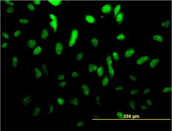 TCF4 Antibody (clone 3E10)