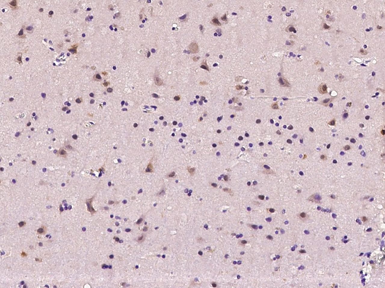 Polyclonal Rabbit anti-Human MOAP1 / MAP1 Antibody (IHC)