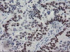 MEIS3 Antibody (aa1-261, clone OTI1B2)