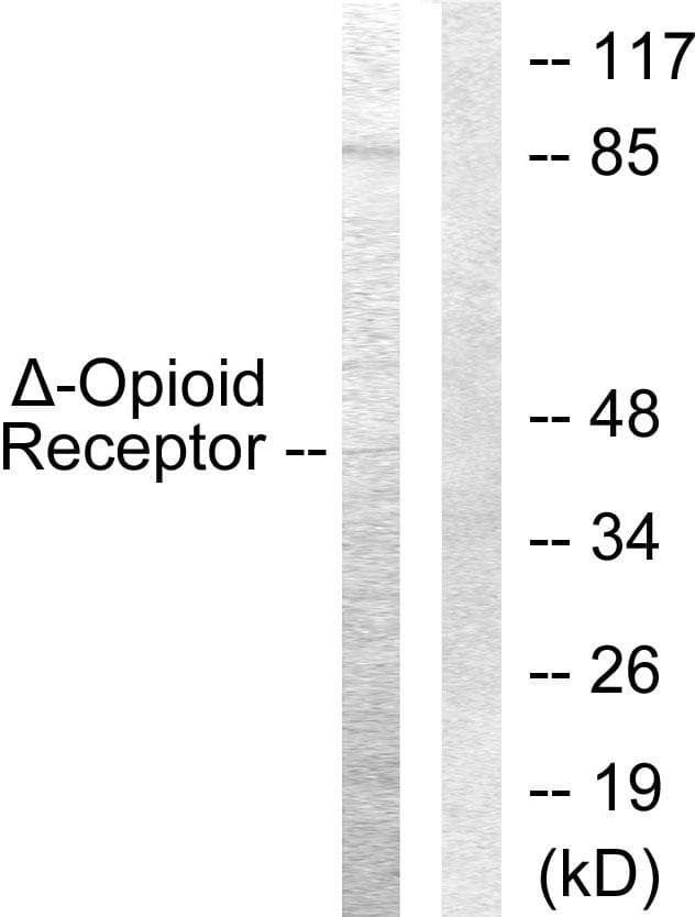 Polyclonal Rabbit anti-Human OPRD1 / Delta Opioid Receptor Antibody (p363, IHC, WB)