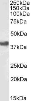 IHC-plus™ CD32B Antibody (aa298-310)