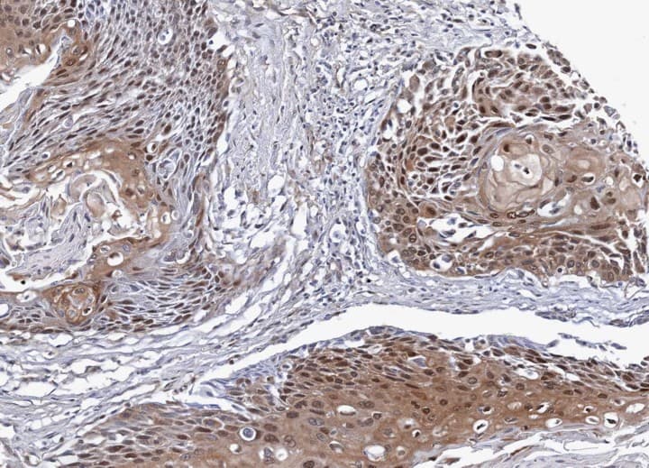 NSFL1C Antibody (aa21-302)