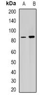 Polyclonal Rabbit anti-Human RPGR Antibody (WB)