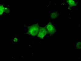 KHK / Ketohexokinase Antibody (clone OTI4E9)