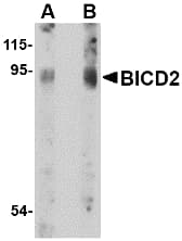 Polyclonal Rabbit anti-Human BICD2 Antibody (WB)