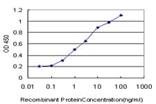 ERCC1 Antibody (clone 3A7)
