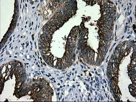 MAC-2-BP / LGALS3BP Antibody (clone 5.00E+03, Carrier-free)