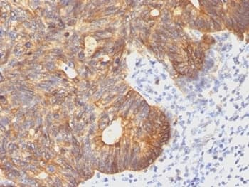 KRT8 / CK8 / Cytokeratin 8 Antibody (clone C-43)