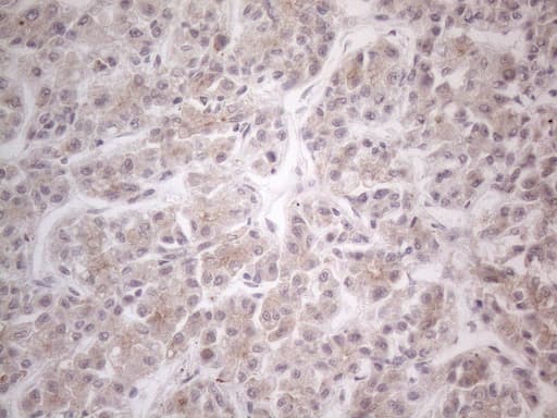 Monoclonal Mouse anti-Human HGF / Hepatocyte Growth Factor Antibody (clone OTI1D2, aa200-494, IHC, WB)