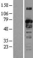 SNX9 / WISP Protein (Over-Expression Lysate Myc-DDK (Flag))