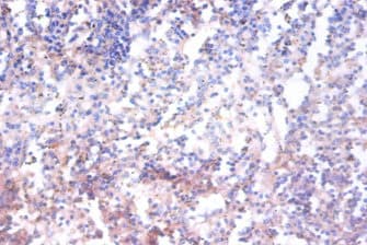 Polyclonal Rabbit anti-Human MAPK14 / p38 Antibody (IHC, WB)