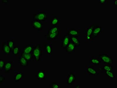 MED22 Antibody