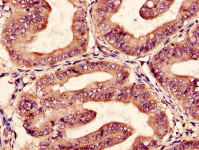 EPO / Erythropoietin Antibody