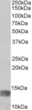 IHC-plus™ Polyclonal Goat anti-Human MIA / CD-RAP Antibody (aa28-40, IHC, WB)