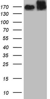 Monoclonal Mouse anti-Human c-Met Antibody (clone OTI2B5, aa125-421, WB)