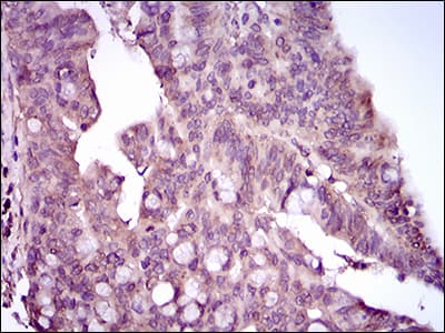 Monoclonal Mouse anti-Human MAPK14 / p38 Antibody (clone 8G4D11, aa299-360, IHC, IF, WB)