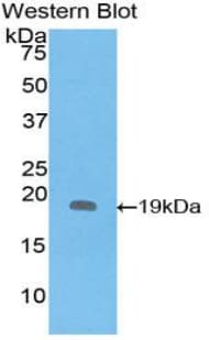 IL1RN Antibody (aa26-177)
