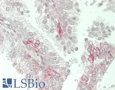 IHC-plus™ AML1 / RUNX1 Antibody (His297)
