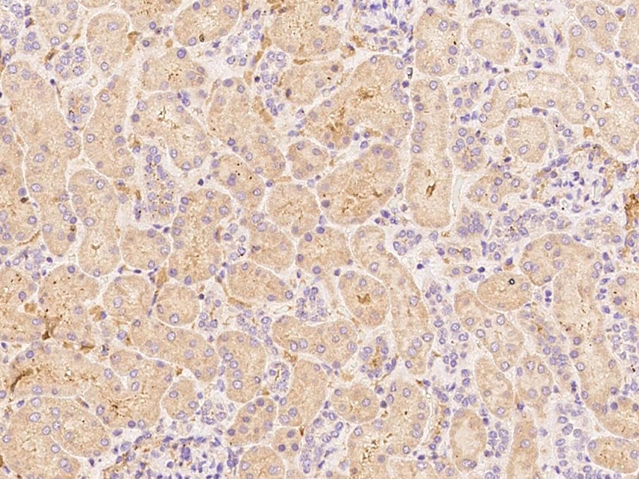 Polyclonal Rabbit anti-Human HGF / Hepatocyte Growth Factor Antibody (Preservative Free, IHC)