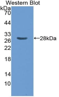 ASGR1 / ASGPR Antibody (aa77-289)