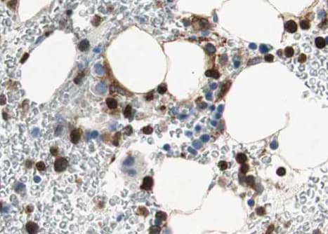 AURKB / Aurora-B Antibody (phospho-Thr232)