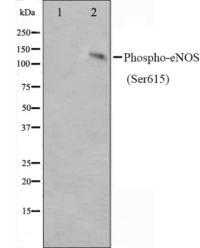 NOS3 / eNOS Antibody (phospho-Ser615)