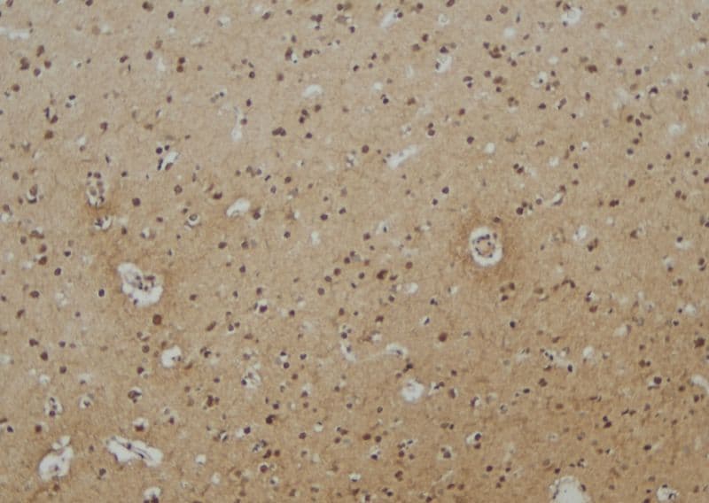 Polyclonal Rabbit anti-Human EPN3 Antibody (IHC, IF, WB)