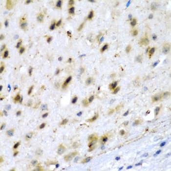 TPH2 Antibody