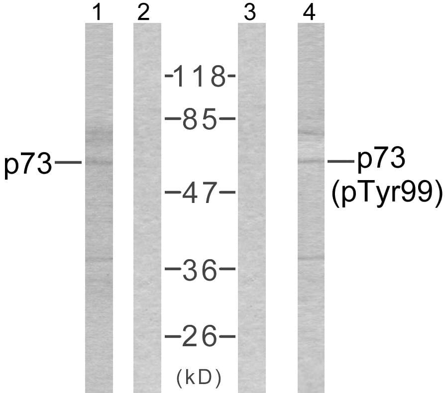 TP73 / p73 Antibody (phospho-Tyr99)