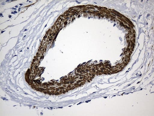 ACTA2 / Smooth Muscle Actin Antibody (N-Terminus, clone UMAB237)