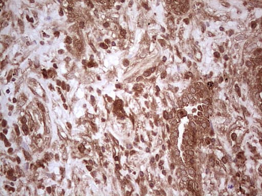 UBE2D2 / UBCH5B Antibody (clone OTI2C2, Carrier-free)