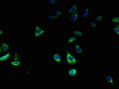 IHC-plus™ Polyclonal Rabbit anti-Human ZDHHC2 Antibody (IHC, IF)