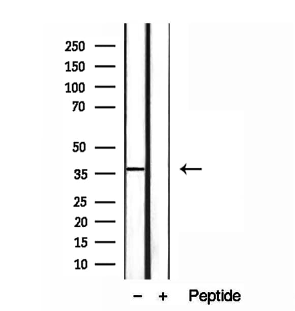 MAT2B Antibody