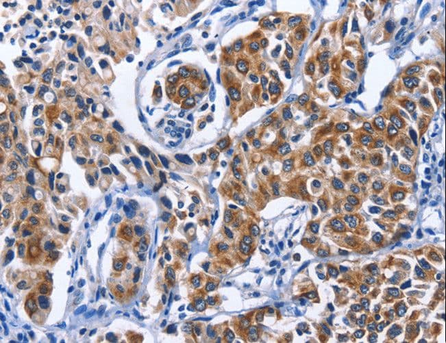 MYH1 Antibody