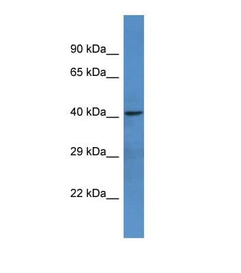 NTNG1 / Netrin G1 Antibody (aa286-335)