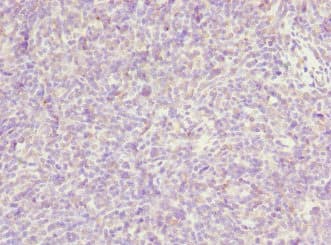 TP53AIP1 / p53 AIP1 Antibody