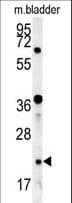 LOH12CR1 Antibody (aa167-196)