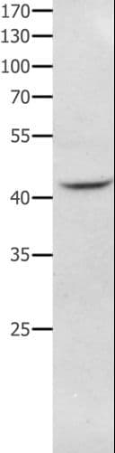 Polyclonal Rabbit anti-Human NFKBID / IkappaBNS Antibody (IHC, WB)